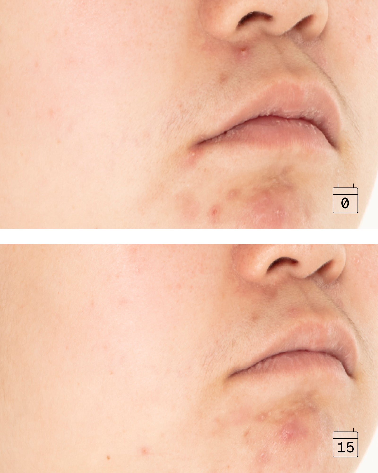 16-in-1 Anti-Aging Cream for Oily & Combination Skin