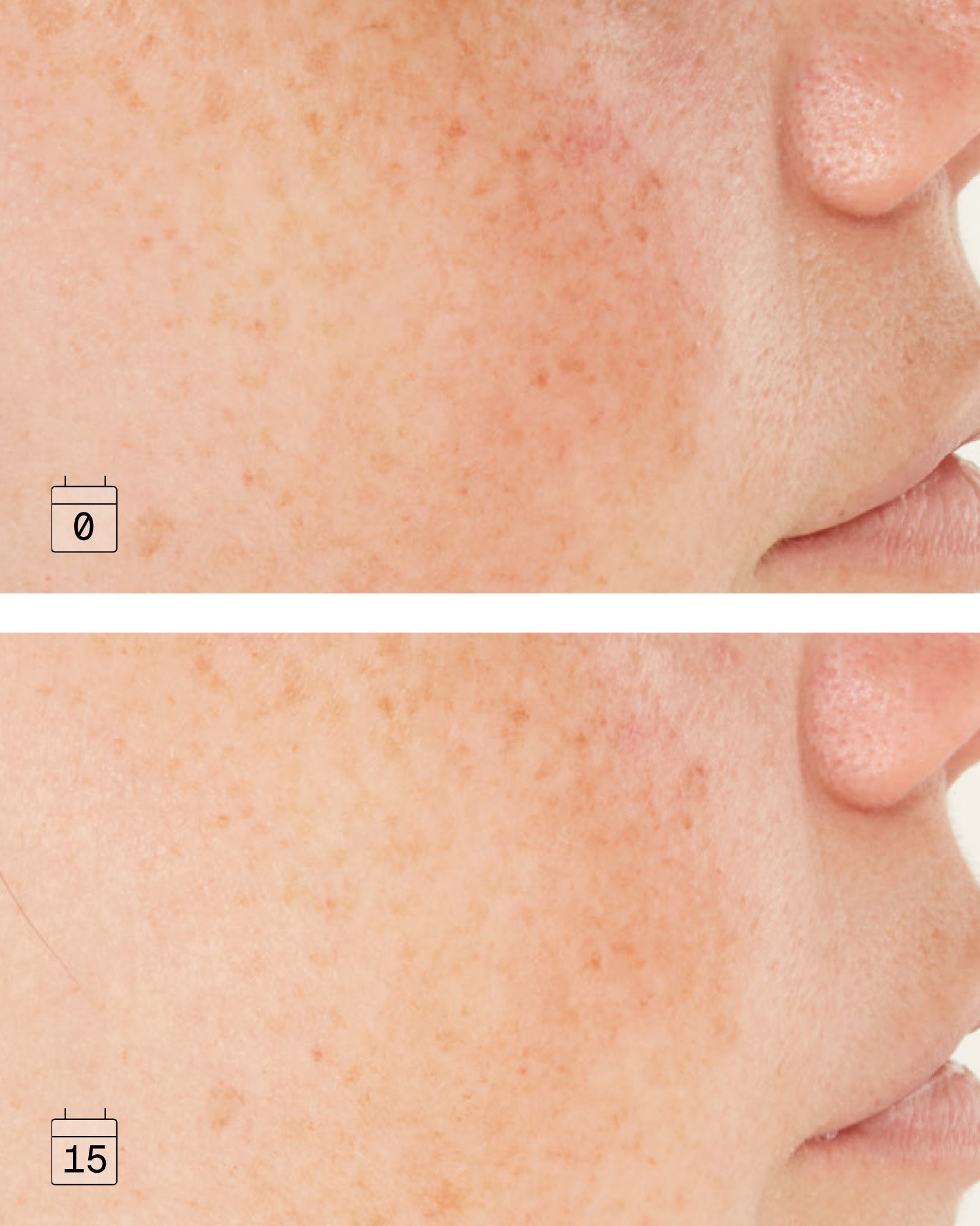 Boost Niacinamide B3 | Anti-Dark Spot Correcting Serum