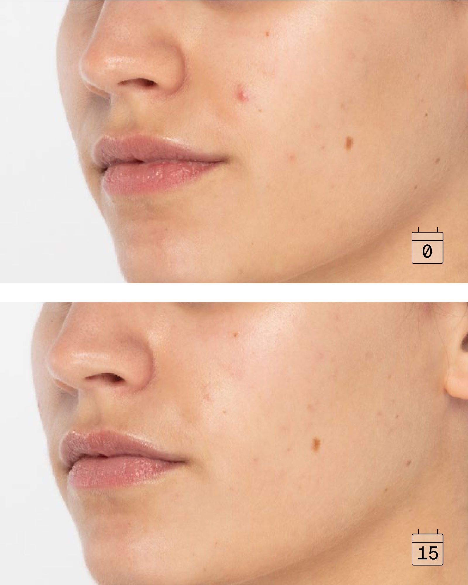 Glōwfix Peel | Daily Brightening Resurfacing Pads