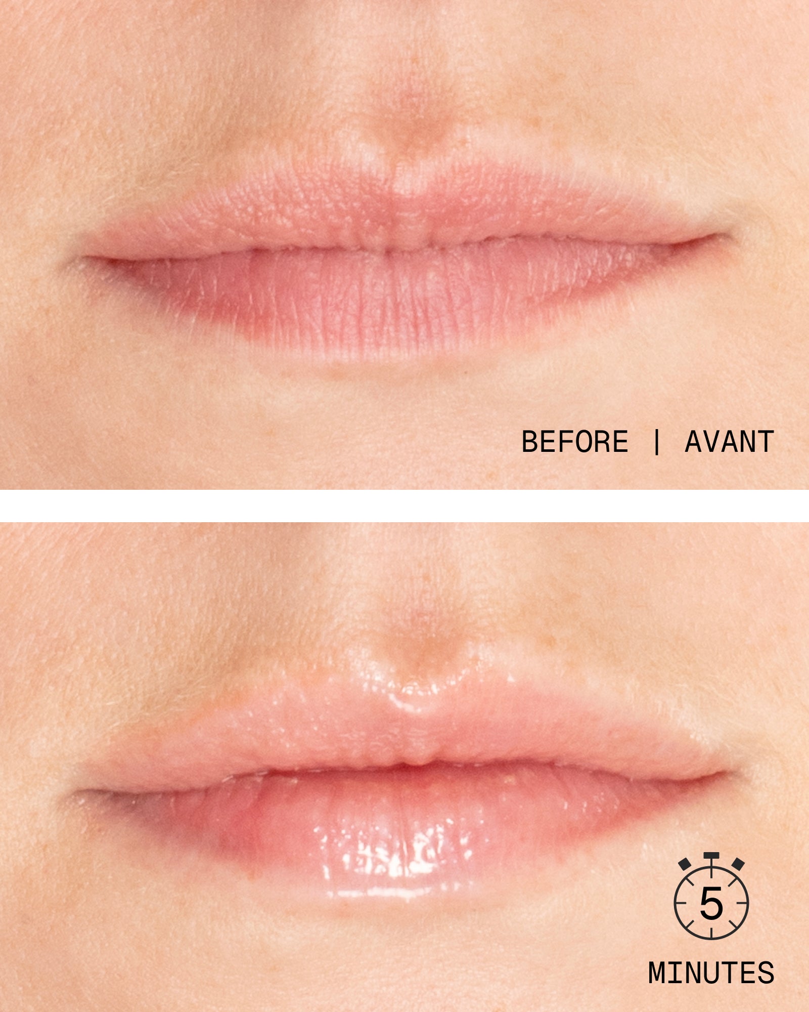 GLŌWFIX Plump | Advanced Lip Maximizer