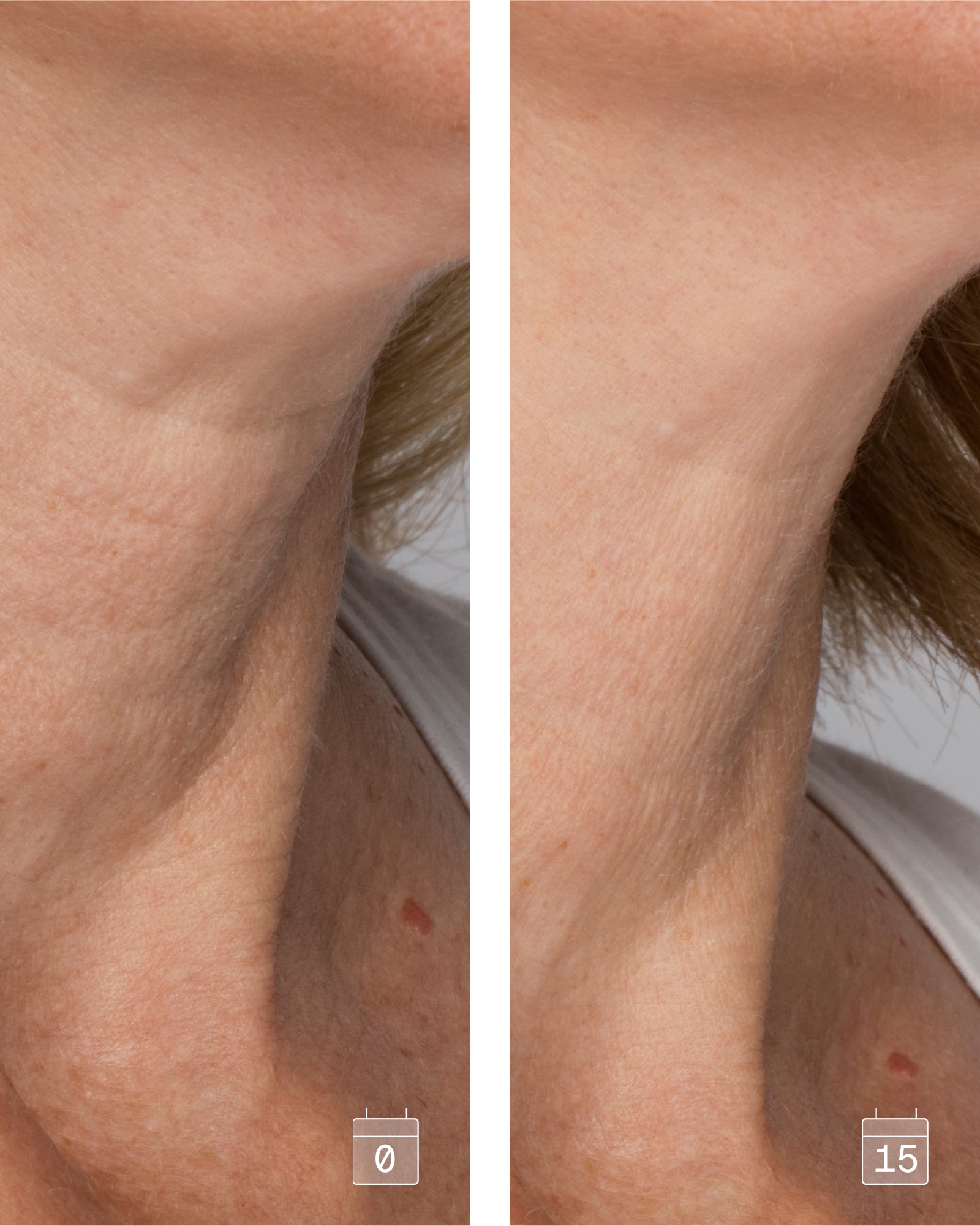 Profil Décolleté | Crème raffermissante et lissante