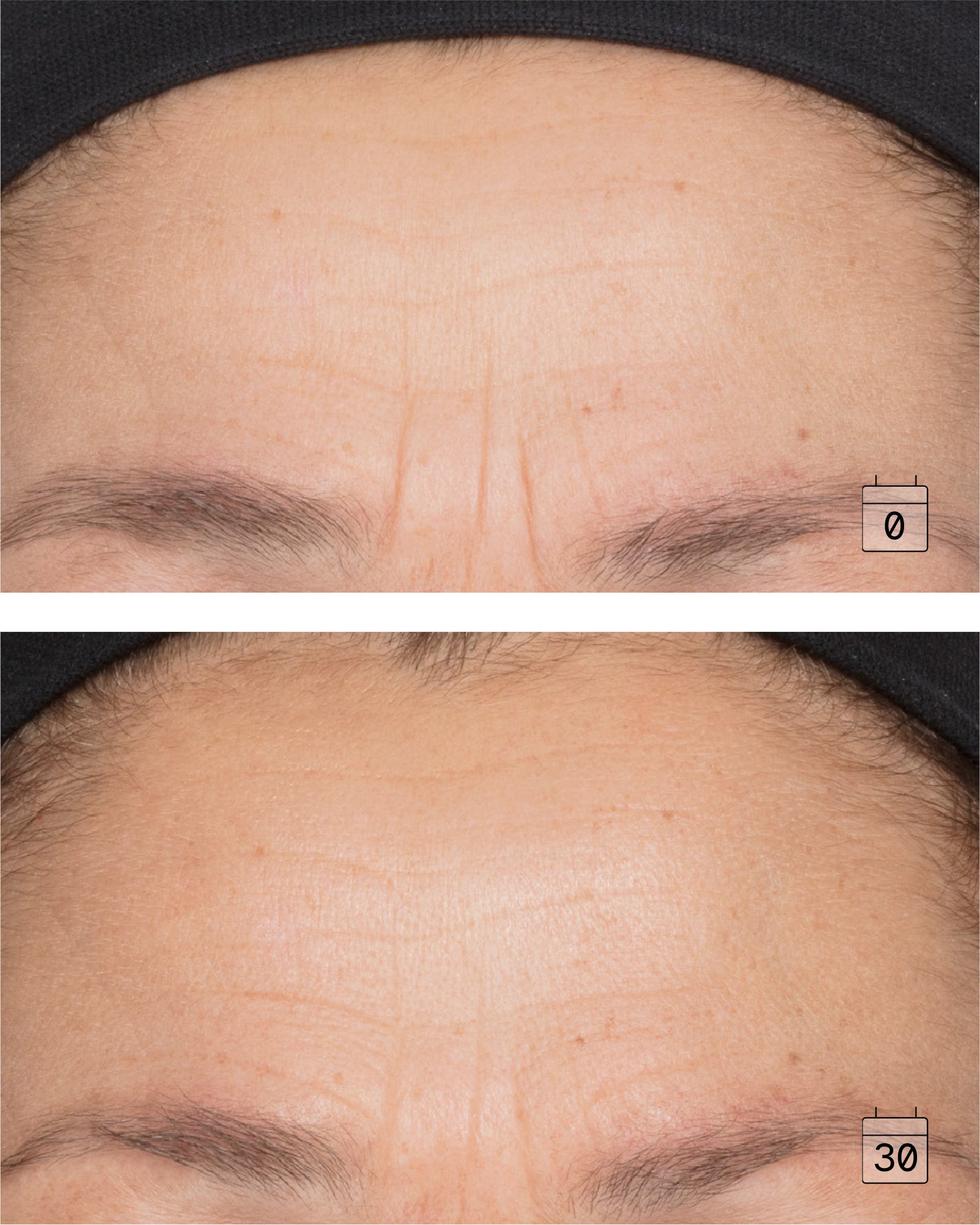 Ultime Expression+ | Deep Wrinkle Concentrate