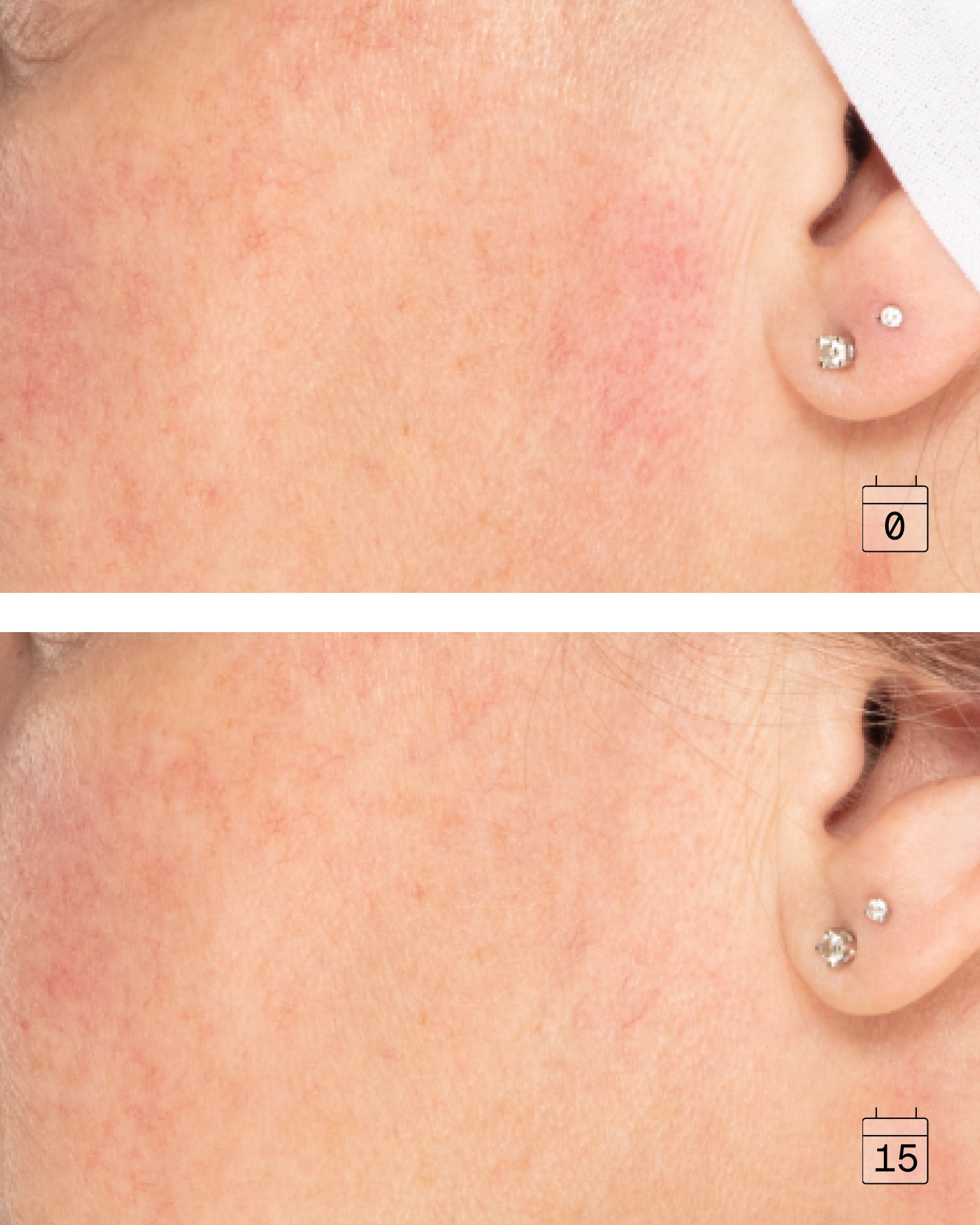 Crème Anti-Âge 16-en-1 – Peaux Sensibles - Sans Parfum									