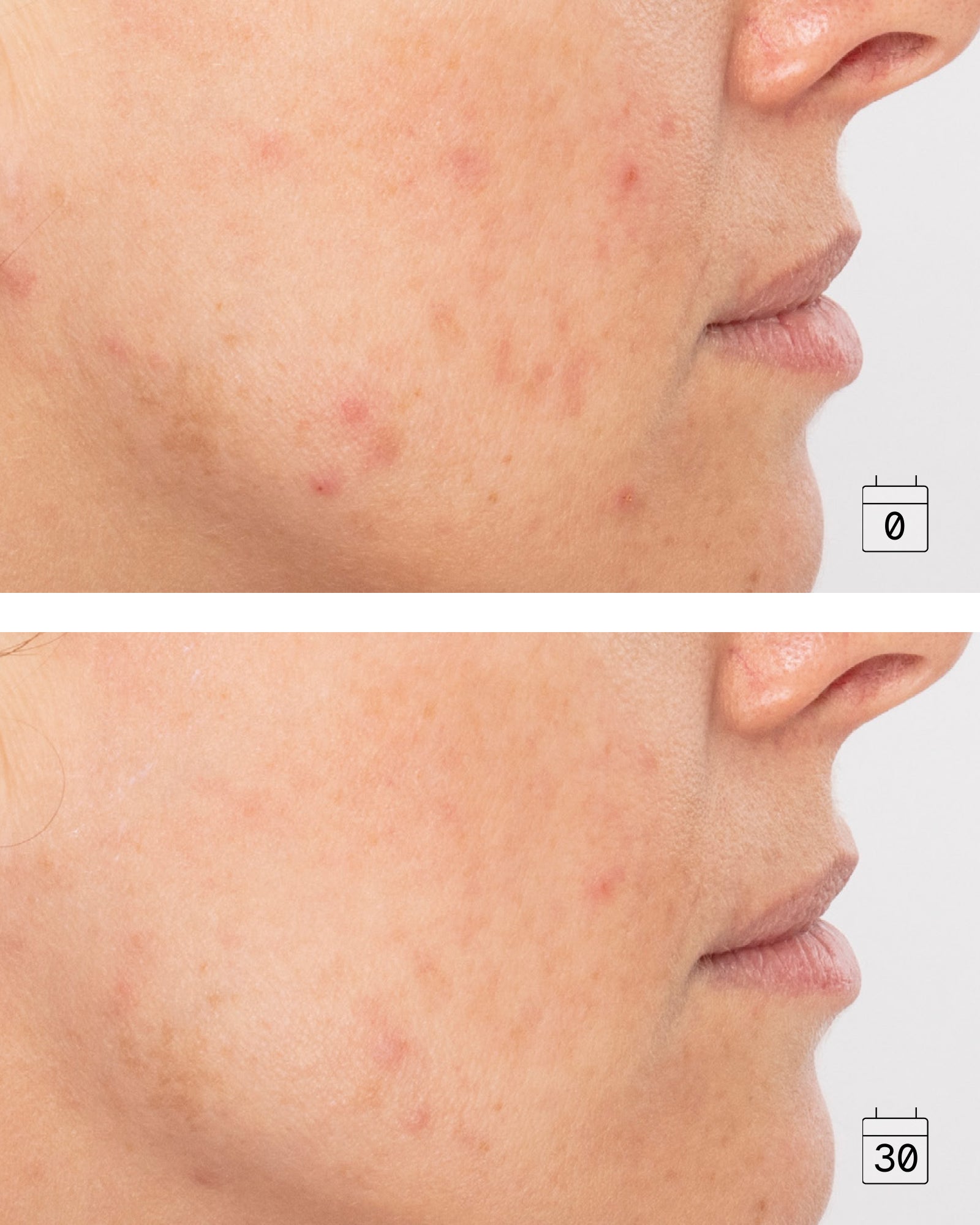 Boost Vitamin C | Radiance and Even Skin Tone Serum