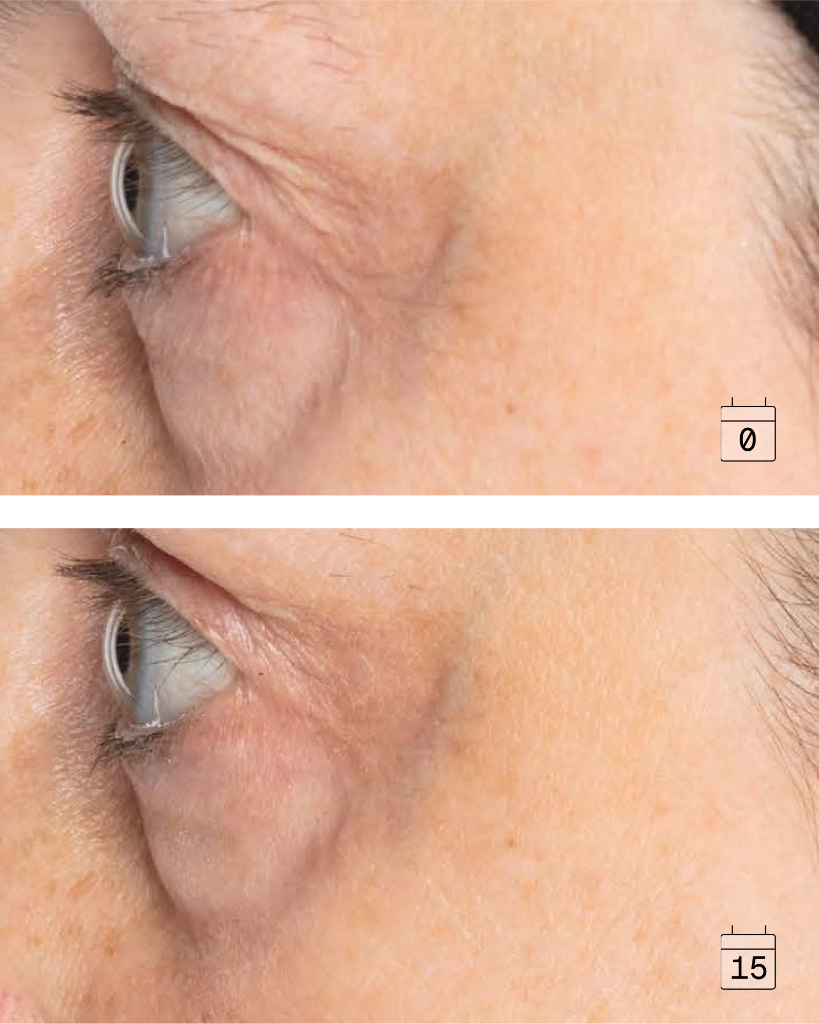 Boost Collagen | Lifting and firming Serum 10ml