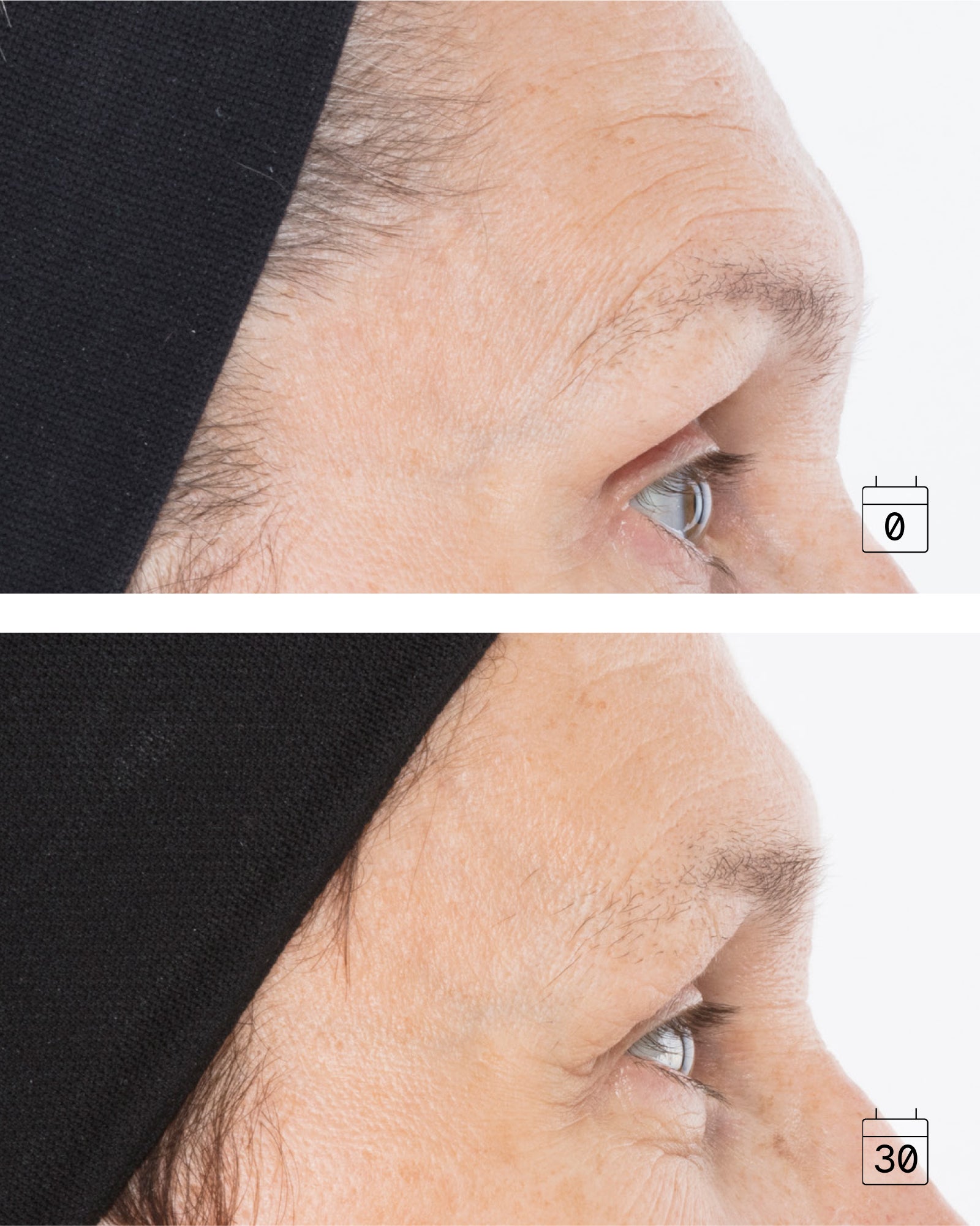 Ideal Advanced Repair | Anti-wrinkle and Firming Serum
