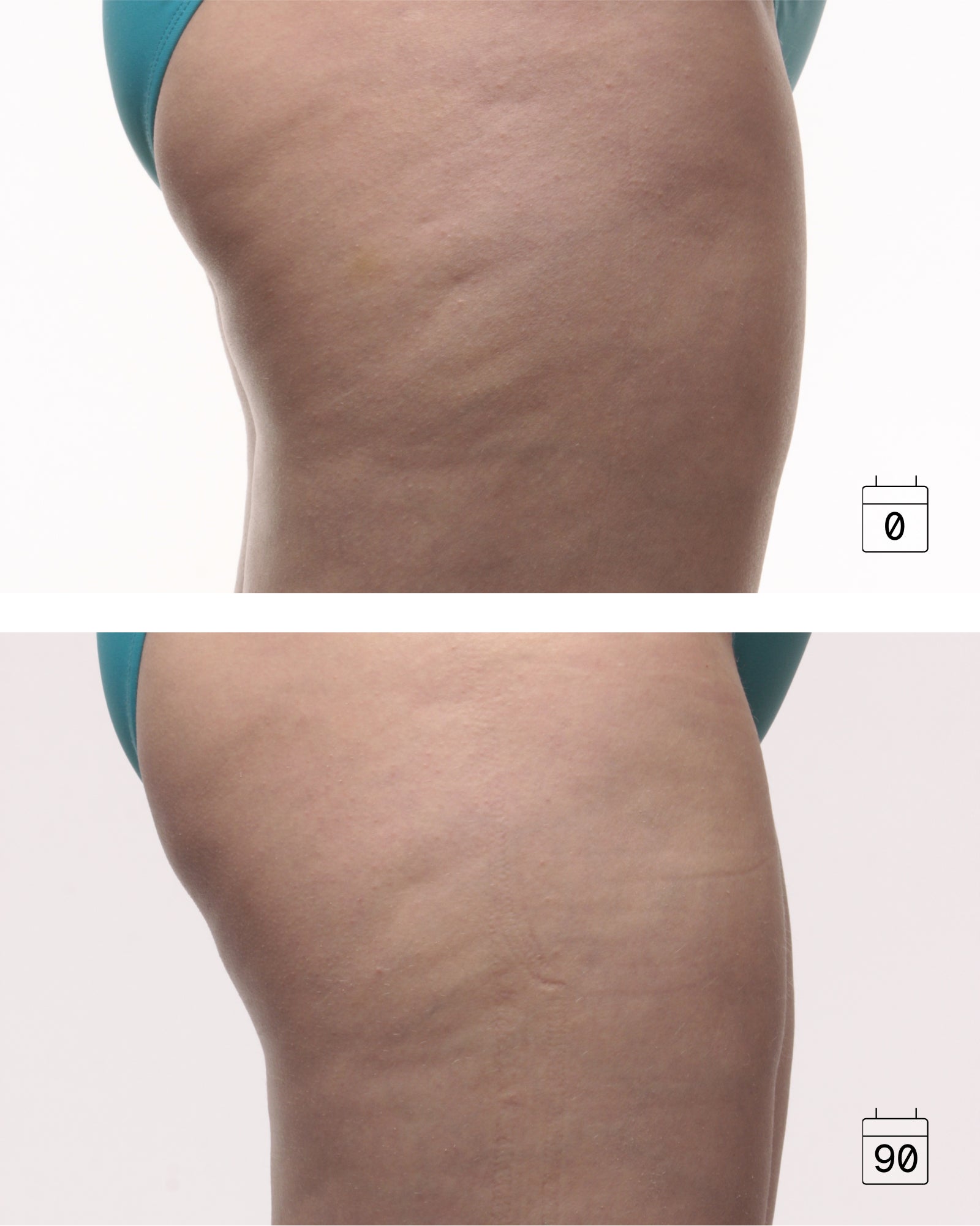 Cure Intensive anti-cellulite