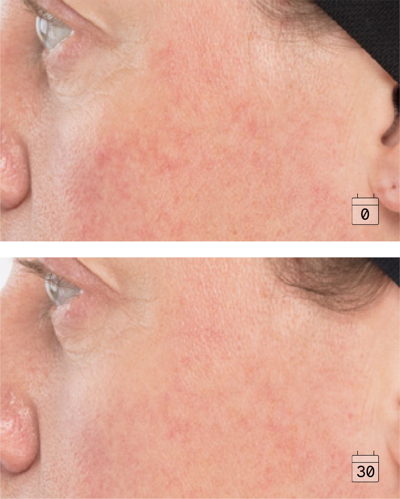 Ultime Comfort | Crème anti-âge antirougeurs