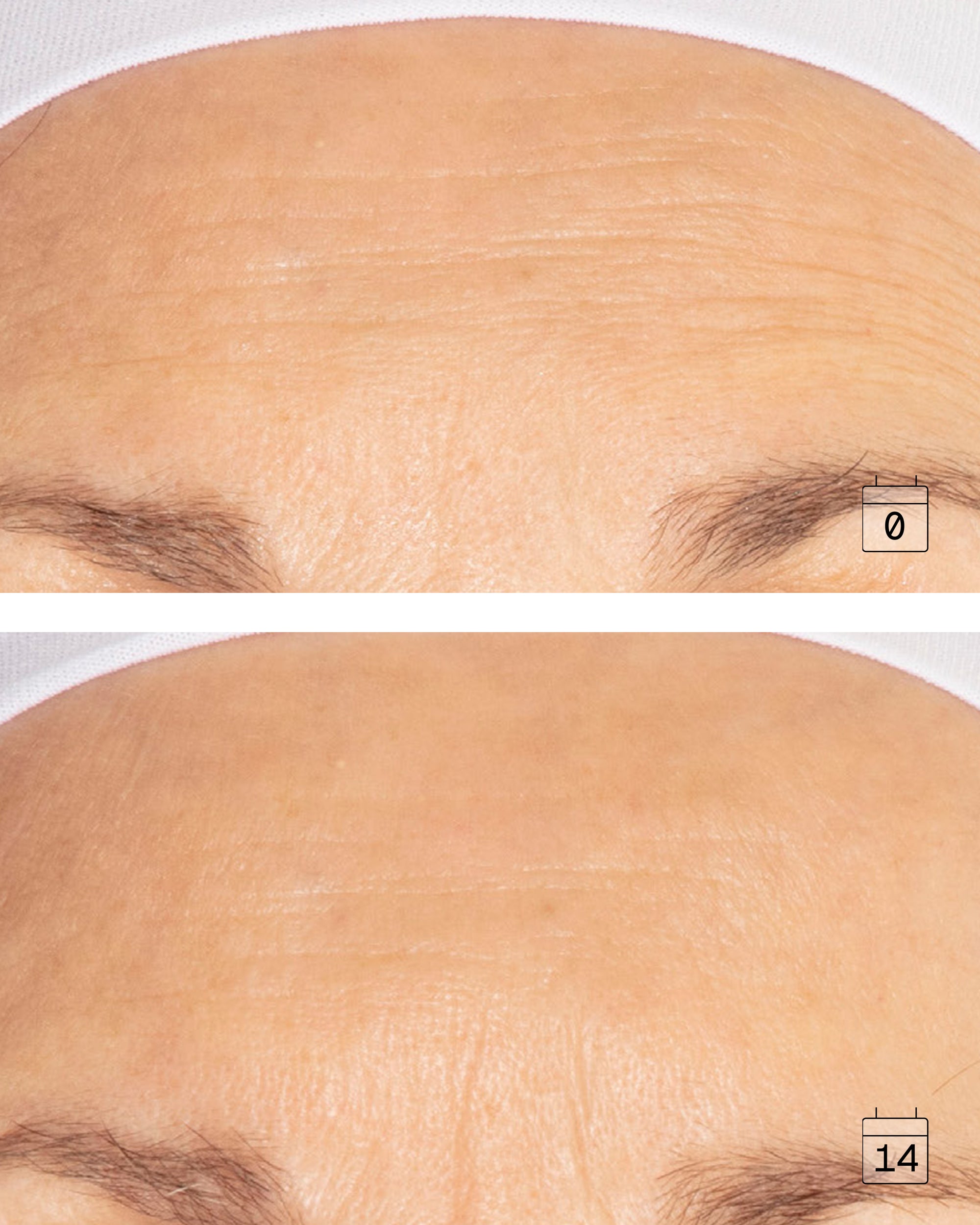 Ultime Premium Micro Serum | Nutri-Omega Redensifying Concentrate